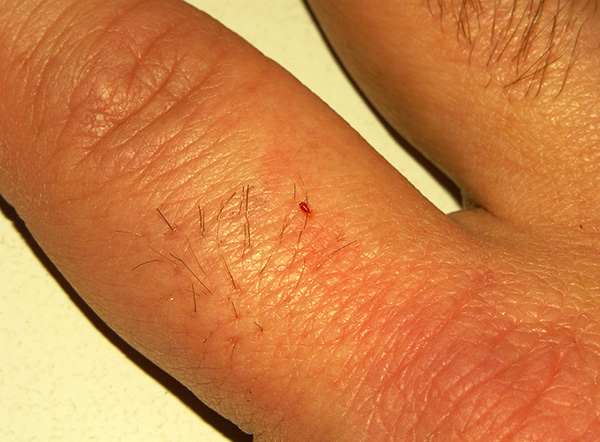 Larve de punaise Larve de punaise