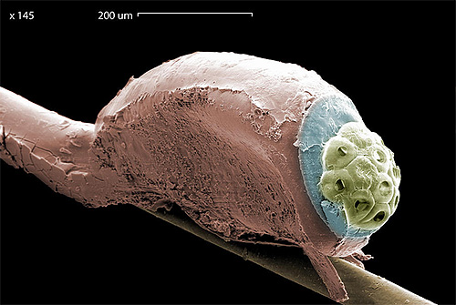 Photographie d'une lente de pou de tête au microscope électronique