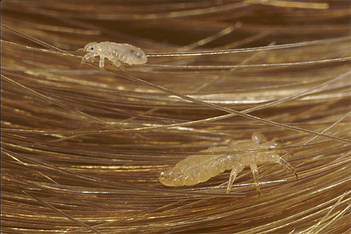 Pou de tête adulte et nymphe