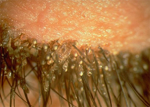 Une autre photographie de lentes sur les cils Une autre photographie de lentes sur les cils
