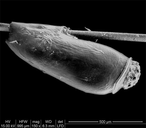Voici à quoi ressemble une lente au microscope électronique. Voici à quoi ressemble une lente au microscope électronique.
