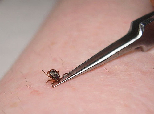 Procédure d'extraction d'une tique du corps Procédure d'extraction d'une tique du corps