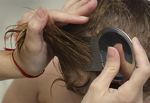 Grâce aux peignes spéciaux contre les poux, on peut retirer efficacement les lentes des cheveux