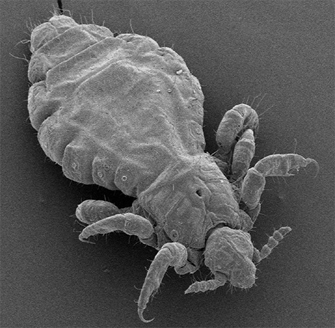Voici à quoi ressemble un pou de tête au microscope électronique Voici à quoi ressemble un pou de tête au microscope électronique