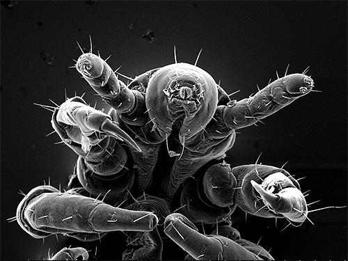 Un pou de corps au microscope électronique