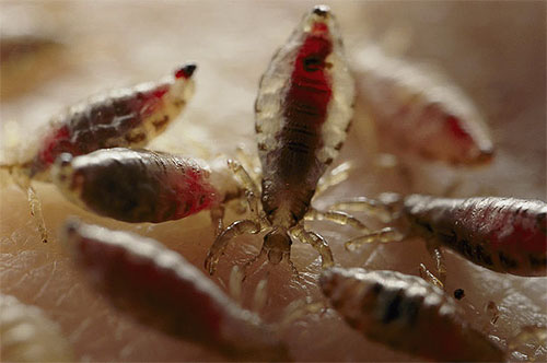 Chaque pou n'absorbe pas beaucoup de sang lors du repas, mais en cas de grand nombre de parasites et de piqûres massives, ces pertes de sang peuvent être importantes