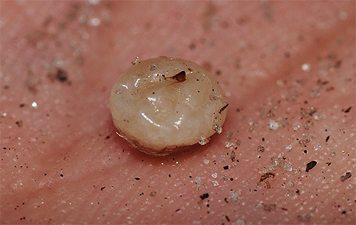 Sur la photo, une femelle de puce de sable extraite de la peau au point de piqûre Sur la photo, une femelle de puce de sable extraite de la peau au point de piqûre