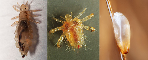 Découvrons les particularités de l'apparence et de la biologie de différentes espèces de poux, voyons à quoi ils ressemblent et comment ils se reproduisent. Découvrons les particularités de l'apparence et de la biologie de différentes espèces de poux, voyons à quoi ils ressemblent et comment ils se reproduisent.