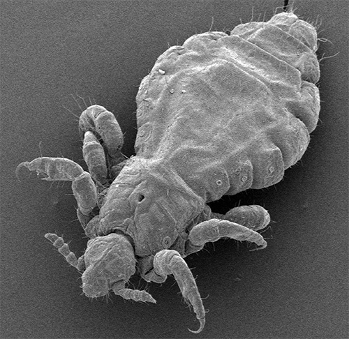 Pou de tête au microscope. Pou de tête au microscope.