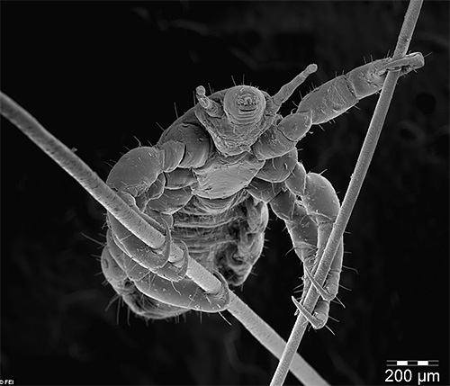 Pou de tête sur des cheveux vu au microscope Pou de tête sur des cheveux vu au microscope