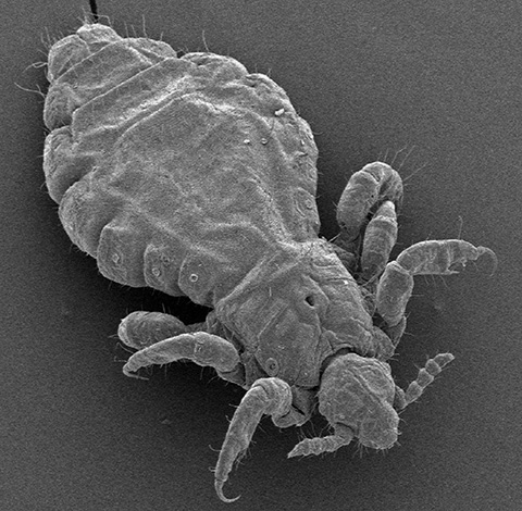Une autre photo d'un pou de tête prise au microscope électronique Une autre photo d'un pou de tête prise au microscope électronique