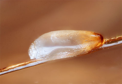 Essayons de comprendre quelles méthodes de retrait des lentes des cheveux sont les plus efficaces et les plus sûres à utiliser. Essayons de comprendre quelles méthodes de retrait des lentes des cheveux sont les plus efficaces et les plus sûres à utiliser.