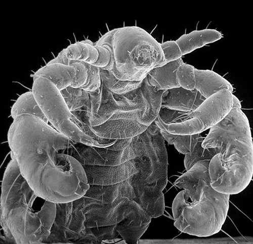 Voici à quoi ressemble un pou du pubis au microscope électronique Voici à quoi ressemble un pou du pubis au microscope électronique