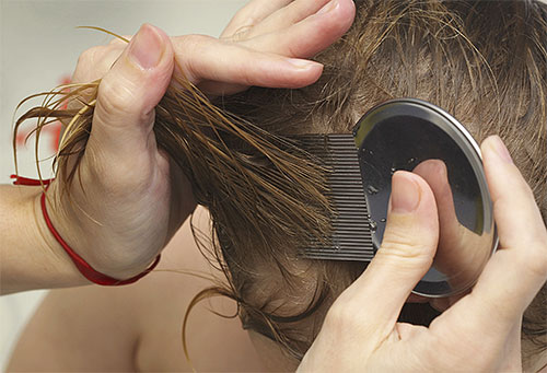 En utilisant un peigne anti-poux, vous devez peigner soigneusement les cheveux de votre enfant, mèche par mèche