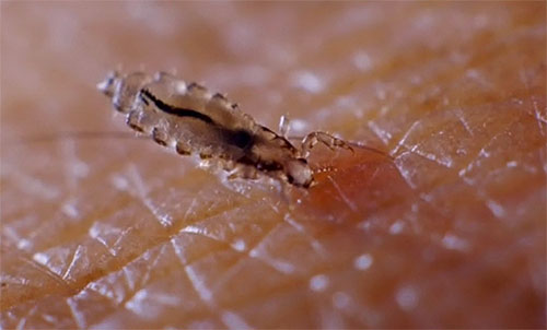 En pénétrant sur la peau et dans les voies respiratoires, le Dichlorvos peut causer à la santé humaine des dommages encore plus importants que les poux eux-mêmes. En pénétrant sur la peau et dans les voies respiratoires, le Dichlorvos peut causer à la santé humaine des dommages encore plus importants que les poux eux-mêmes.