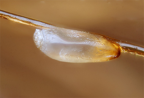Si vous n'avez pas réussi à vous débarrasser des lentes du premier coup, le traitement doit être répété après un certain temps. Si vous n'avez pas réussi à vous débarrasser des lentes du premier coup, le traitement doit être répété après un certain temps.
