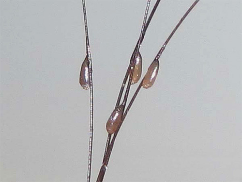 Malheureusement, même les insecticides modernes ne permettent pas toujours de se débarrasser des lentes. Malheureusement, même les insecticides modernes ne permettent pas toujours de se débarrasser des lentes.