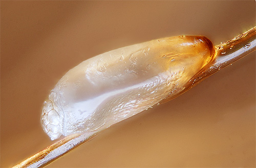 Le shampooing Veda, dans ses deux variantes, a peu d'effet sur les lentes. Le shampooing Veda, dans ses deux variantes, a peu d'effet sur les lentes.