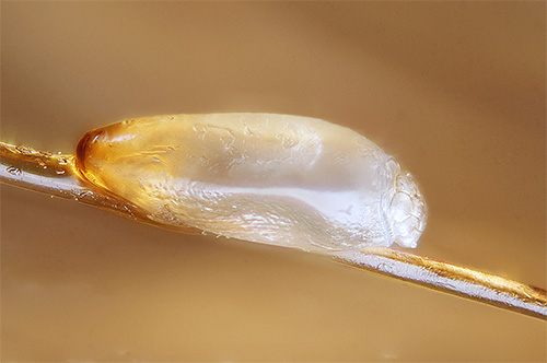 La découverte de lentes sur les cheveux témoigne sans équivoque de la présence de poux.