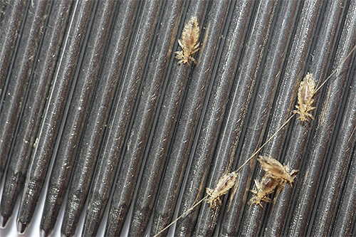 Des peignes spéciaux pour démêler les poux et les lentes aident à se débarrasser définitivement des parasites.