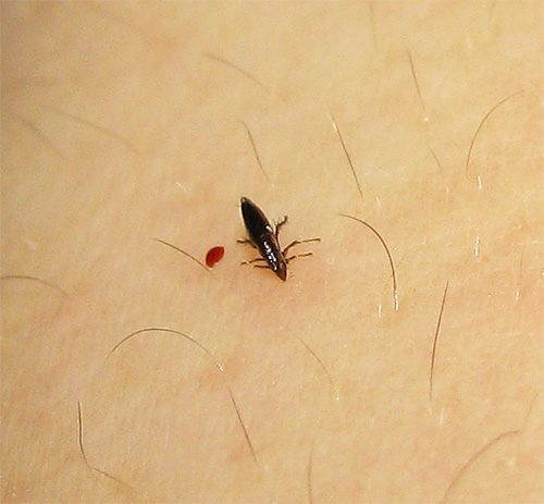 Les piqûres de puces peuvent être à l'origine de certaines maladies infectieuses