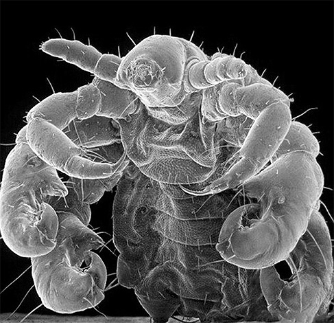 Et voici une photo de pou au microscope électronique. Et voici une photo de pou au microscope électronique.