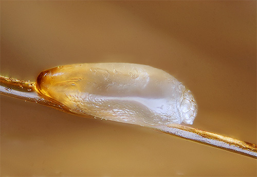 Et voici à quoi ressemble une lente sur un cheveu vue au microscope avec un fort grossissement