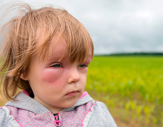 Lors des premiers secours à un enfant, il faut se rappeler que de nombreux médicaments contre les allergies ne sont pas destinés à être administrés aux enfants. Lors des premiers secours à un enfant, il faut se rappeler que de nombreux médicaments contre les allergies ne sont pas destinés à être administrés aux enfants.