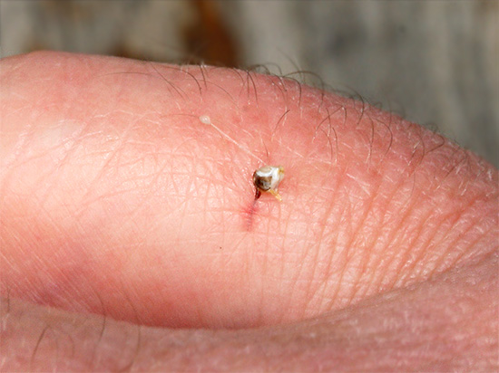 Si, après une piqûre d’insecte, un dard dépasse de la plaie, il s’agissait d’une abeille. Si, après une piqûre d’insecte, un dard dépasse de la plaie, il s’agissait d’une abeille.