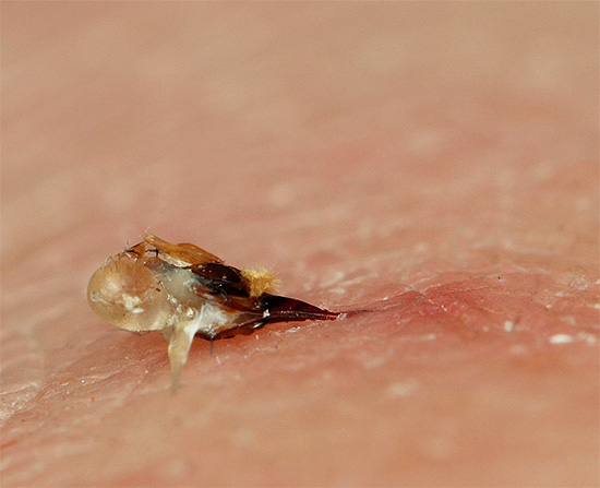 Dard d’abeille dans la peau humaine. Dard d’abeille dans la peau humaine.