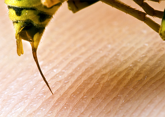 Utiliser les piqûres de guêpes et d'abeilles pour un traitement personnel n'est non seulement pas bénéfique, mais aussi très dangereux. Utiliser les piqûres de guêpes et d'abeilles pour un traitement personnel n'est non seulement pas bénéfique, mais aussi très dangereux.