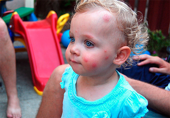 Les jeunes enfants peuvent parfois réagir de manière très vive, même aux piqûres de moustiques ordinaires. Les jeunes enfants peuvent parfois réagir de manière très vive, même aux piqûres de moustiques ordinaires.
