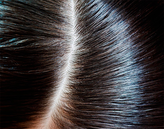 Après la procédure, il n'y aura même pas de lentes sèches dans les cheveux. Après la procédure, il n'y aura même pas de lentes sèches dans les cheveux.