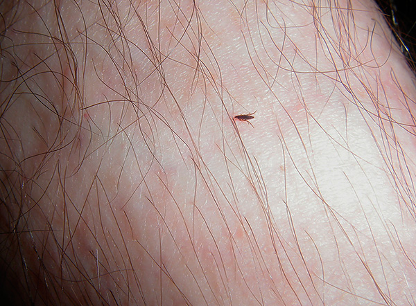 Puce sur la peau humaine Puce sur la peau humaine