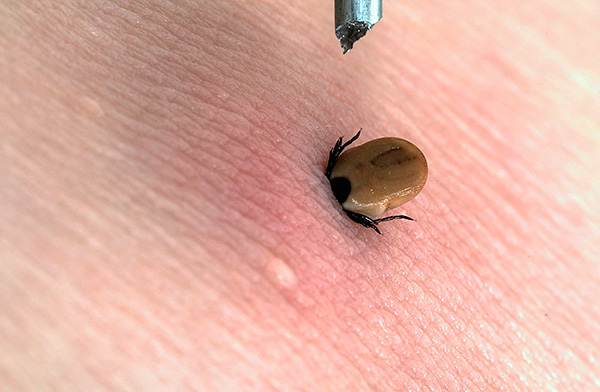 Extraire simplement la tique fixée de force n'a pas de sens et est même dangereux.