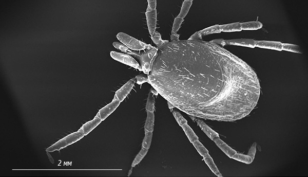 Photographie d'une tique de la taïga au microscope électronique.