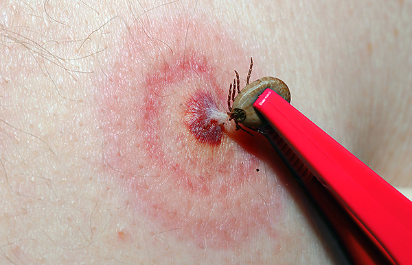 Plus le parasite se nourrit de sang, plus il sécrète de salive dans la plaie (la salive contient souvent les agents pathogènes de maladies dangereuses pour l'homme et les animaux).