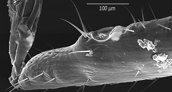 Voici à quoi ressemblent les épines sous un fort grossissement (image obtenue à l'aide d'un microscope électronique à balayage).