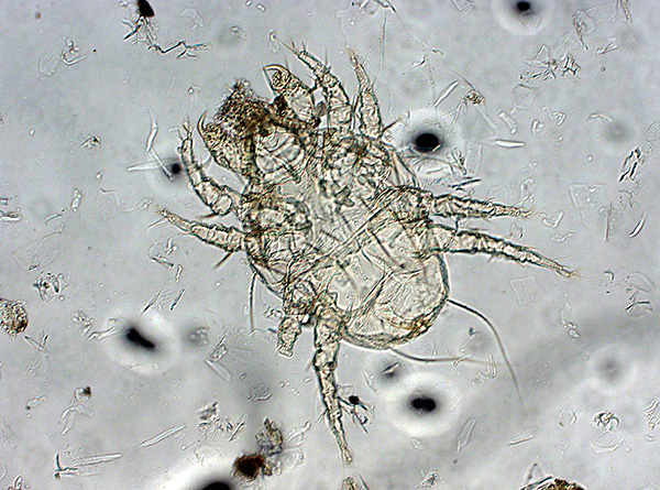 Sarcopte de la gale (Sarcoptes scabiei) Sarcopte de la gale (Sarcoptes scabiei)