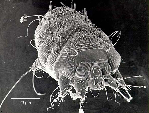 Ce parasite vit dans l'épaisseur de la peau, y creuse des galeries et se nourrit de l'épiderme. Ce parasite vit dans l'épaisseur de la peau, y creuse des galeries et se nourrit de l'épiderme.