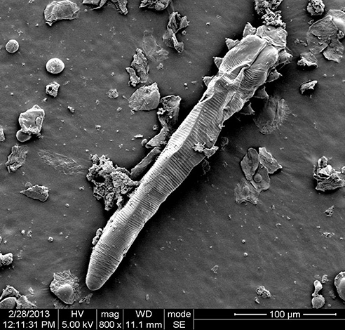 Demodex folliculorum Demodex folliculorum