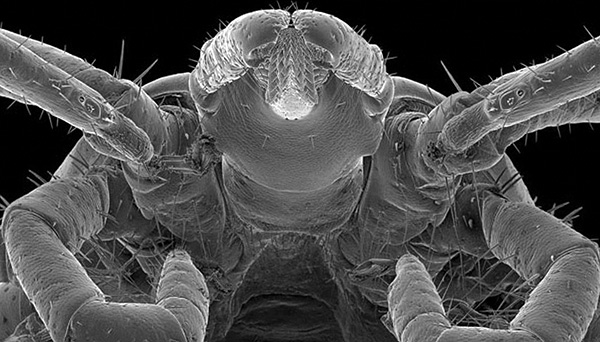 Voici à quoi ressemble la tête d'une tique Ixodidae à fort grossissement.