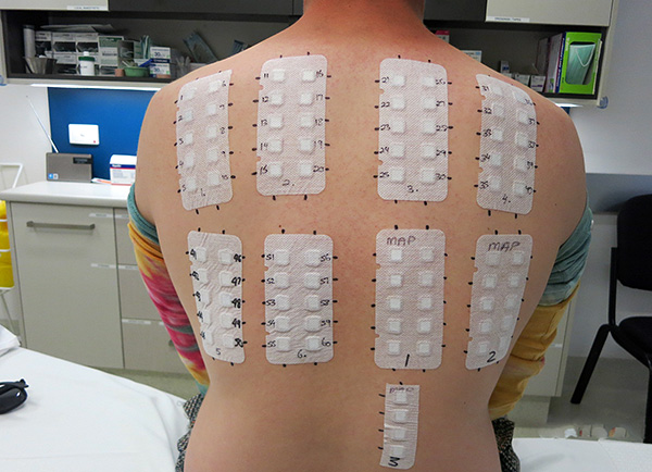 Exemple d'utilisation du patch-test