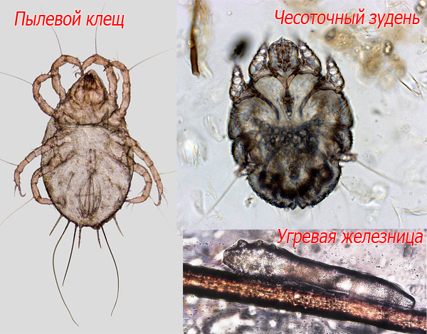 Voici à quoi ressemblent au microscope un acarien domestique, un sarcopte de la gale et un demodex.