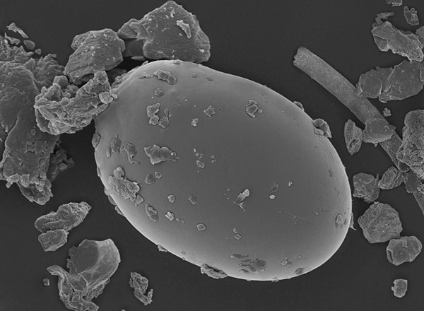 Voici à quoi ressemble un œuf d'acarien vu au microscope électronique.