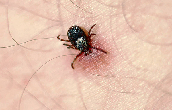 Pendant la prise de sang, le parasite injecte dans la plaie sa salive, qui peut contenir l'infection. Pendant la prise de sang, le parasite injecte dans la plaie sa salive, qui peut contenir l'infection.