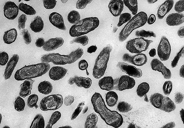 L'agent de la fièvre Q (Coxiella burnetii) L'agent de la fièvre Q (Coxiella burnetii)