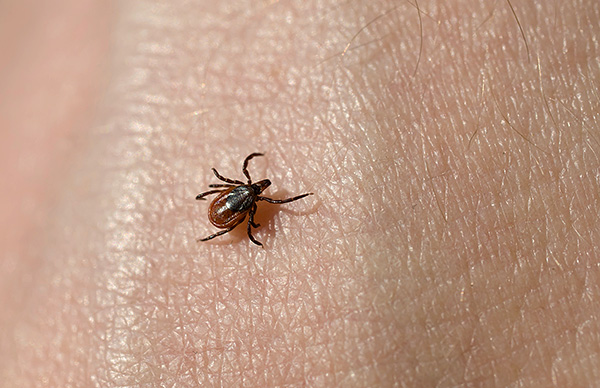 Heureusement, toutes les morsures de parasites (même celles d'un porteur d'infection) n'entraînent pas une maladie chez l'homme. Heureusement, toutes les morsures de parasites (même celles d'un porteur d'infection) n'entraînent pas une maladie chez l'homme.