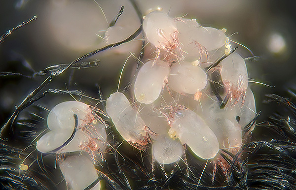 Si l'on ne maintient pas un niveau d'hygiène suffisant dans la zone de couchage, les acariens dermatophages peuvent s'y reproduire en grande quantité.