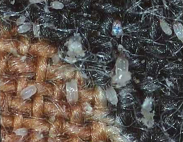 Acariens Dermatophagoides dans un tapis